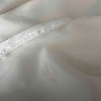Trendyol’da Satıcı Leke Gerekçesiyle İade Talebimi Reddetti