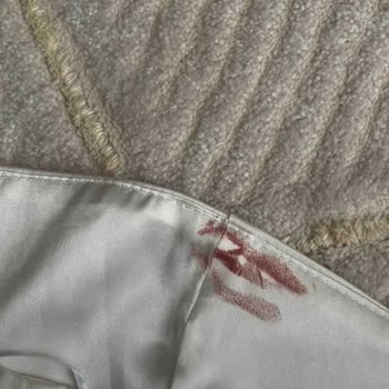 Trendyol’da Satıcı Leke Gerekçesiyle İade Talebimi Reddetti