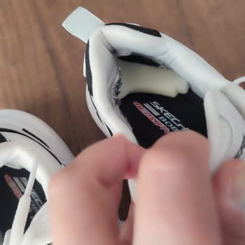 Skechers Ayakkabısı 4 Ayda Açıldı: Değişim Veya İade Talebi