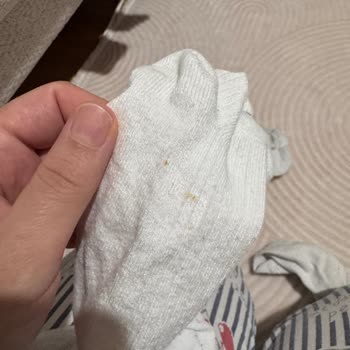 Pas Lekeli Arçelik Çamaşır Makinesinde Korozyon, Tam Değişim İsteği