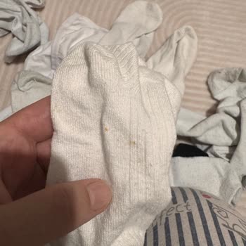 Pas Lekeli Arçelik Çamaşır Makinesinde Korozyon, Tam Değişim İsteği