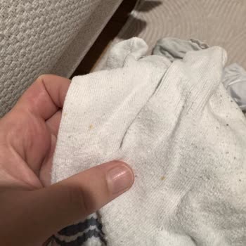 Pas Lekeli Arçelik Çamaşır Makinesinde Korozyon, Tam Değişim İsteği
