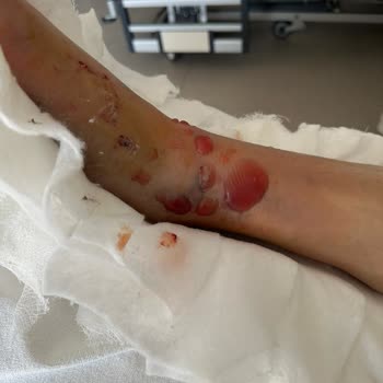 Kocaeli Devlet Hastanesi Doktorun Hatası ve Yanlış Teşhis Koyması