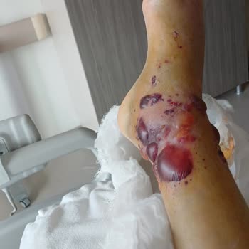 Kocaeli Devlet Hastanesi Doktorun Hatası ve Yanlış Teşhis Koyması