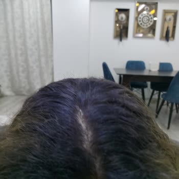 Saç Boyası Sorunu ve Tazmin Talebi
