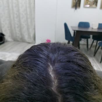 Saç Boyası Sorunu ve Tazmin Talebi
