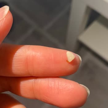Fellas Çilekli Atıştırmalık Barında Sert Yabancı Cisim Tehlikesi