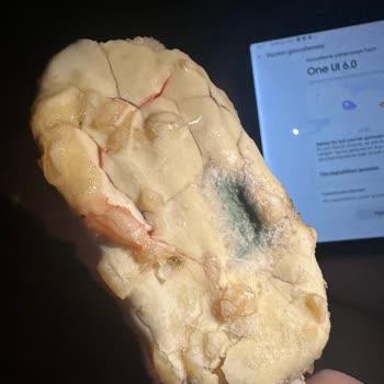 Kırık Magnum Dondurma Çocuğu Hastalık Ve Psikolojik Travmaya Sürükledi