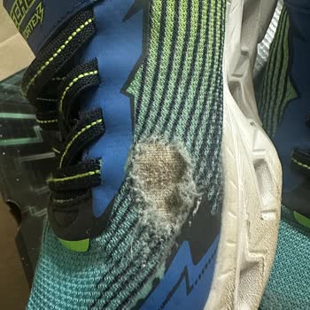 Kısa Sürede Deforme Olan Skechers Çocuk Ayakkabısının İade Talebi Reddedildi