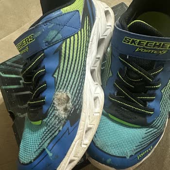 Kısa Sürede Deforme Olan Skechers Çocuk Ayakkabısının İade Talebi Reddedildi