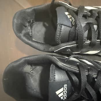 Adidas Ayakkabısının Erken Bozulması Ve Boyner’in Kullanıcı Hatası İddiası