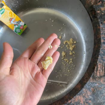 Sütaş Muzlu Sütte Görülen Mukus Benzeri Madde Ve Kesilmiş Süt Çocuk Sağlığını Tehdit Ediyor