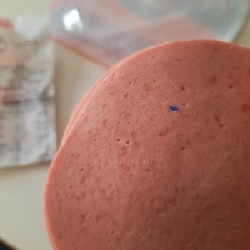 Nimet Salamında Mavi Renkli Yabancı Cisim Bulunması Çocuk Sağlığına Tehdit