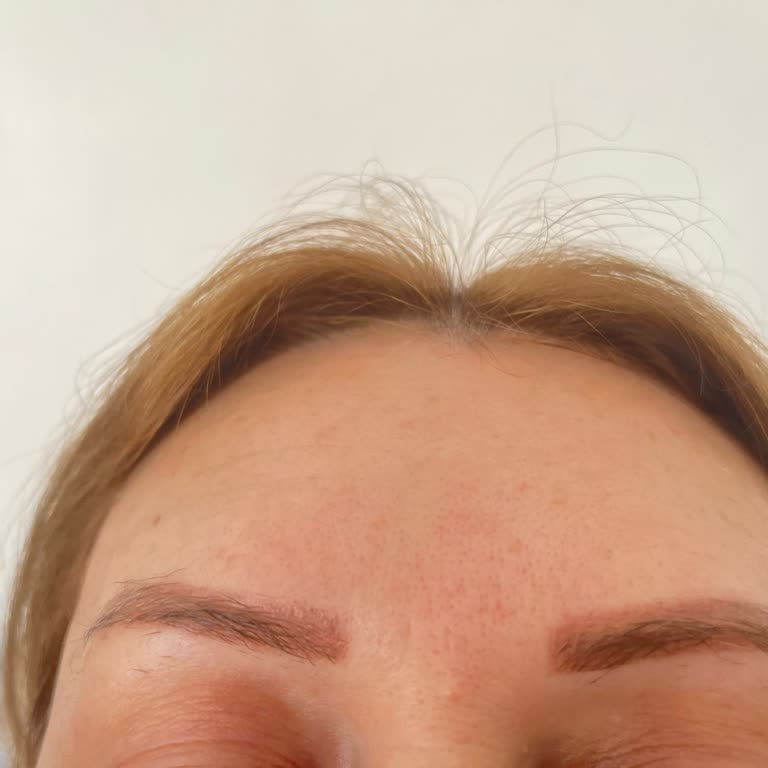 Burçin Berk Beauty Güzellik Merkezi Cildimde Bıraktığı Etki