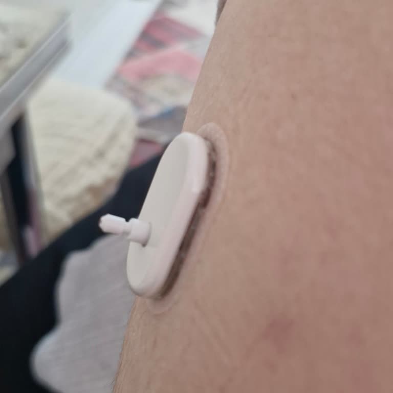 Sibionics Türkiye Sensörünün Mekanik Sorunu Ve Müşteri Hizmetlerinin İlgisizliği