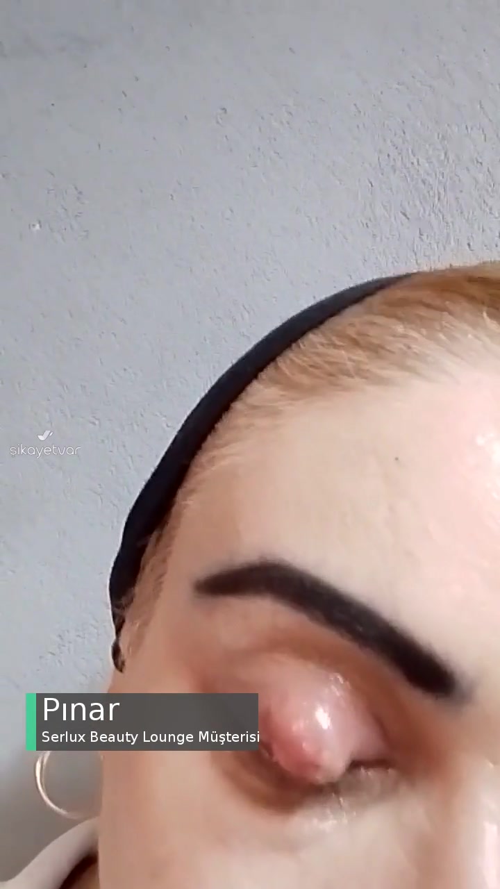 Serlux Beauty Lounge Gözüm Çok Kötü Durumda! videonun kapak resmi