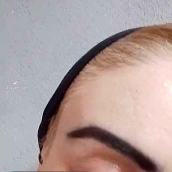 Serlux Beauty Lounge Gözüm Çok Kötü Durumda!