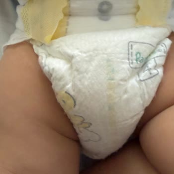 Islaklık Göstergesi Ve Sızıntı Problemi Yaşanan Lot 9350451996 Numaralı Bezler