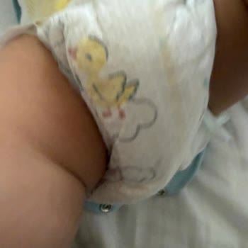 Islaklık Göstergesi Ve Sızıntı Problemi Yaşanan Lot 9350451996 Numaralı Bezler