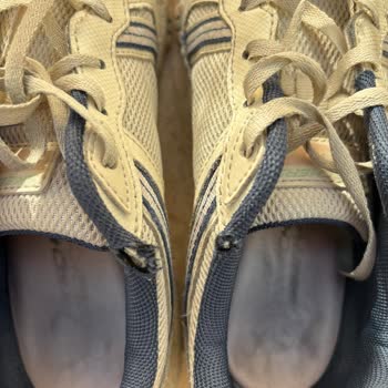 Skechers Çocuk Ayakkabısında Erken Deformasyon, Mağaza Reddine Karşı İtiraz