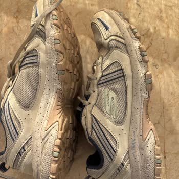 Skechers Çocuk Ayakkabısında Erken Deformasyon, Mağaza Reddine Karşı İtiraz