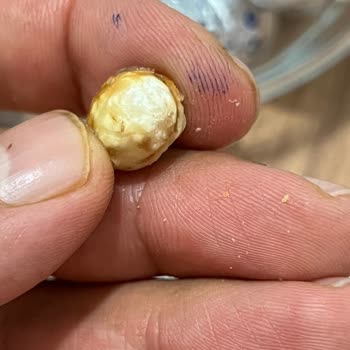 Ülker Ece Çikolatasında Küflü Fındık Ve Kalite Kontrol İhmaline Şikayet