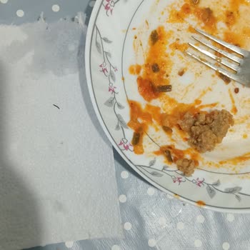 IKEA Dondurulmuş Köfte İçindeki Demir Parçası Diş Hasarına Ve Ağrıya Neden Oldu