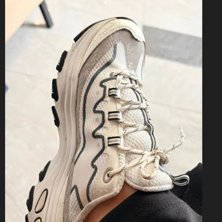 Skechers Ayakkabısında 20 Gün İçinde Şişme Ve Çökme: İade Talebi