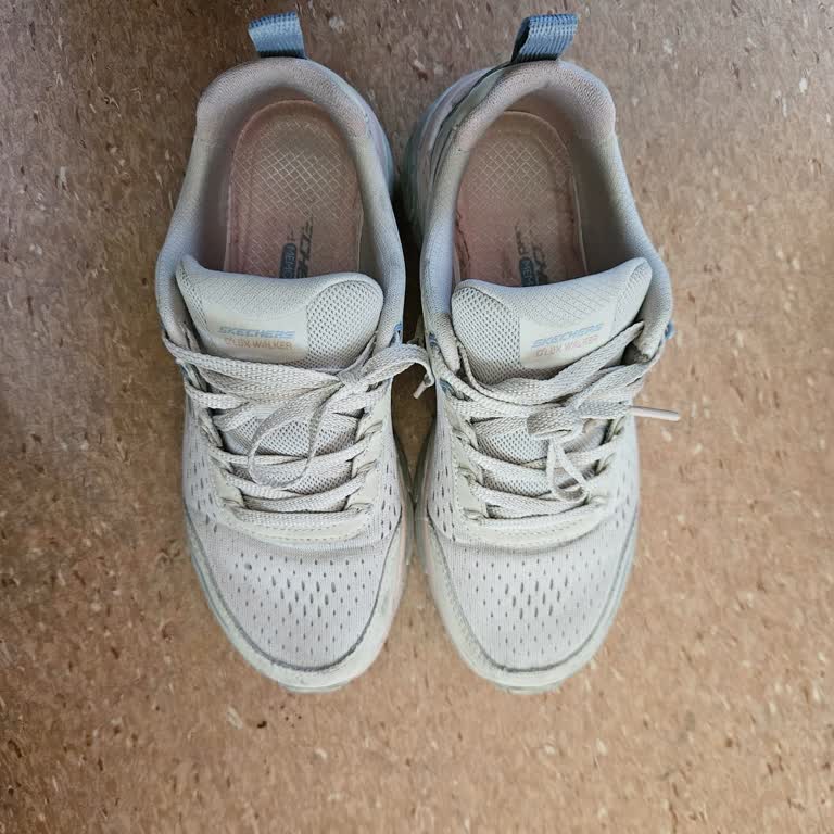 Skechers Kadın Spor Ayakkabısında Ağrı Ve Şişme Üretim Kaynaklı Sorun