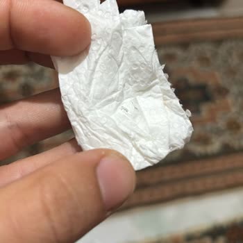 Mango Aromalı Cam Şişe Sodayı İçtiğimde Cam Kırıkları Ve Sağlık Tehlikesi