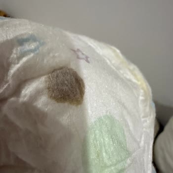 Molfix Bebek Bezinde Yabancı Madde Görülmesi Ve İade Talebi