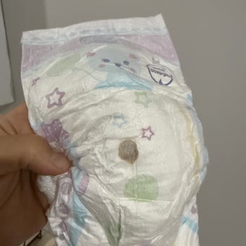 Molfix Bebek Bezinde Yabancı Madde Görülmesi Ve İade Talebi