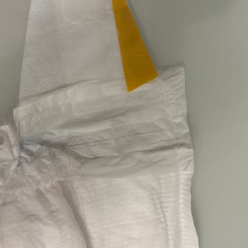 Molfix Bebek Bezinde Aşırı Yapışkan Bant Kalite Endişesi