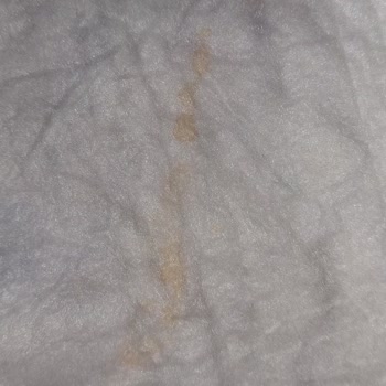 Dalın Islak Mendil Kullanımı Sonrası Bebeğimde Şiddetli Pişik Ve Kanama