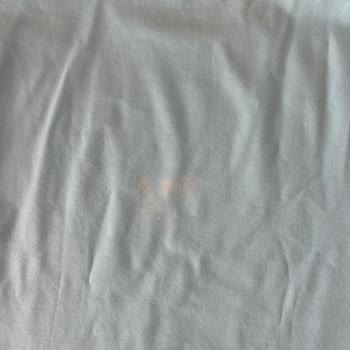 Kumaş Hatası Nedeniyle İade Reddi Ve Yetersiz Müşteri Desteği