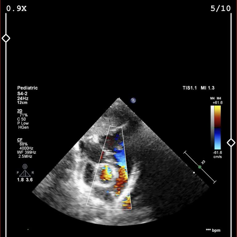 Doktorun Kırıcı İletişimi Çocuğumun Eko Ve EKG Raporlarını Engelliyor