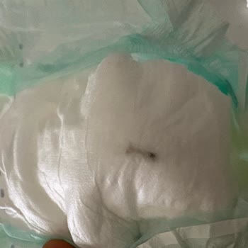 Bebek Bezinde Odun Parçası Bulunması Şok Yarattı