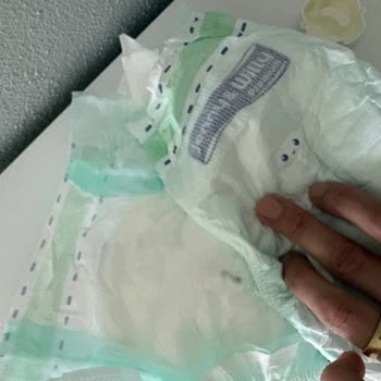 Bebek Bezinde Odun Parçası Bulunması Şok Yarattı