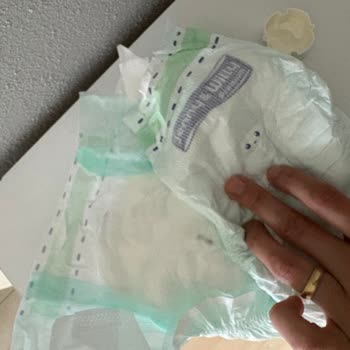 Bebek Bezinde Odun Parçası Bulunması Şok Yarattı