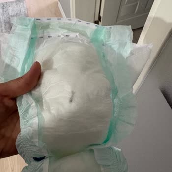Bebek Bezinde Odun Parçası Bulunması Şok Yarattı