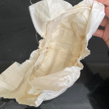 Sleepy Satıcısından Alınan Bebek Bezlerinde Kalite Düşüşü Ve Ücret İadesi Talebi