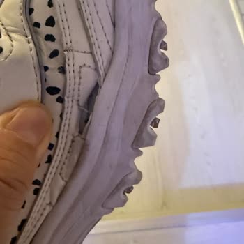 Skechers Ayakkabılarda Erken Yırtılma Ve Mağazadan Çözüm Reddi