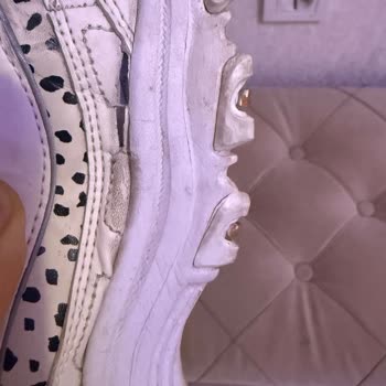 Skechers Ayakkabılarda Erken Yırtılma Ve Mağazadan Çözüm Reddi