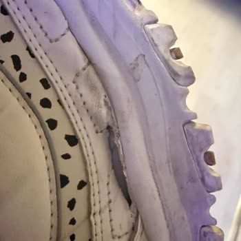 Skechers Ayakkabılarda Erken Yırtılma Ve Mağazadan Çözüm Reddi