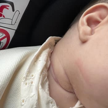 Bebeğin Boynunda Tüy Sorunu: B&G Store Elbisesi İade Talebi