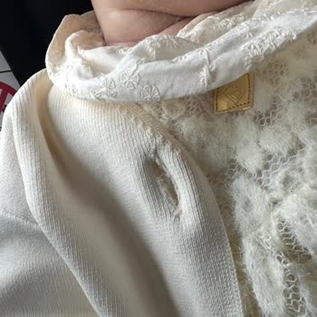 Bebeğin Boynunda Tüy Sorunu: B&G Store Elbisesi İade Talebi