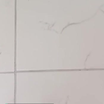 Op. Dr. Mustafa Bolat Kişiye Göre Fiyat Bilgisi Verilmesi