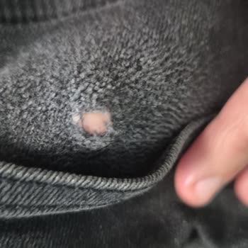 Ayıplı Pantolon Değişimi Reddi Ve Personelin Alaycı Tutumu