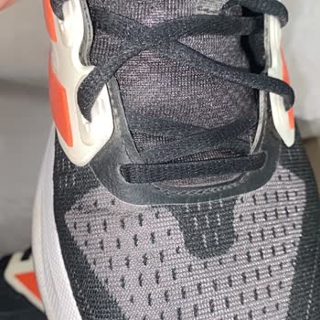 Adidas Ayakkabımın Kısa Sürede Dikiş Atması Ve Mağazanın Kusur Bulamama Kararı