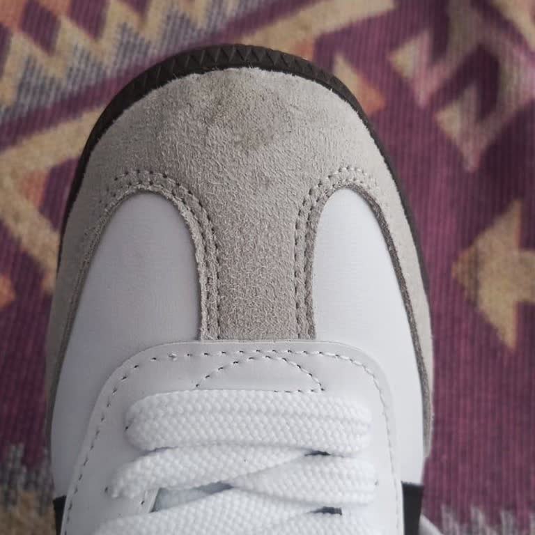 Defolu Adidas Samba Ayakkabı İadesi Ve Ücret İadesi Talebi